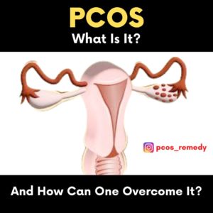 How to overcome PCOS easily and naturally
